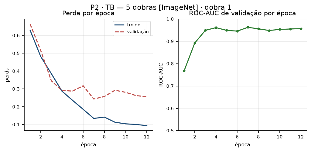 p2_tb_cv_imagenet_treino.png